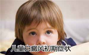 白癜风治疗要从什么方面着手